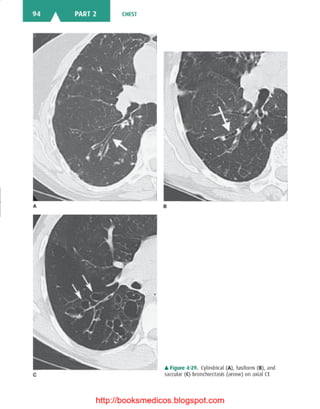 Basic radiology, 2nd ed.