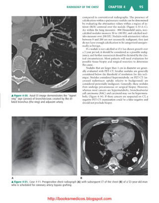 Basic radiology, 2nd ed.