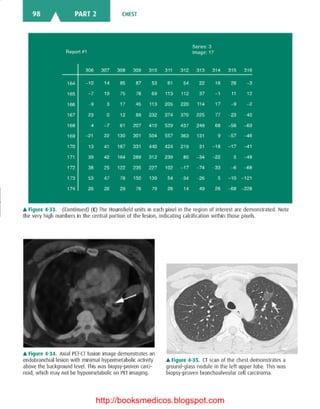 Basic radiology, 2nd ed.
