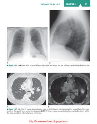 Basic radiology, 2nd ed.