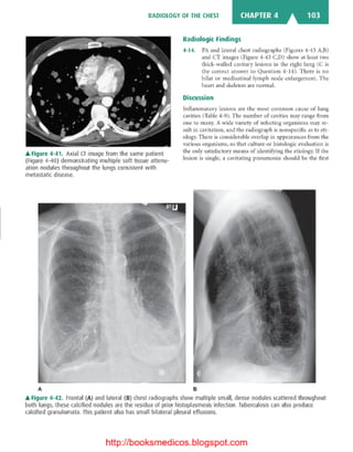 Basic radiology, 2nd ed.