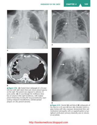 Basic radiology, 2nd ed.