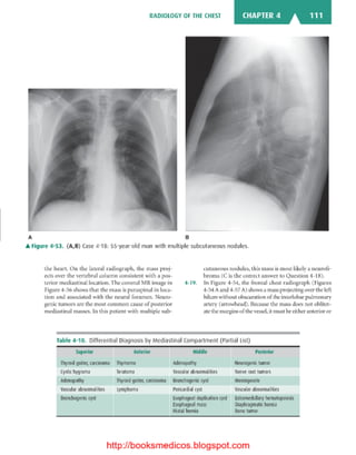 Basic radiology, 2nd ed.