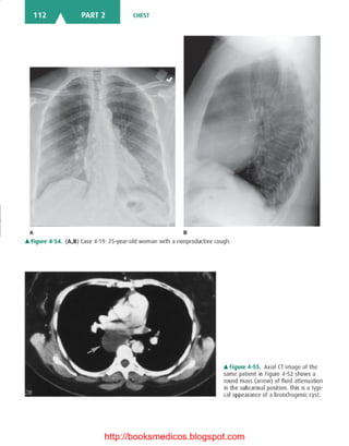 Basic radiology, 2nd ed.