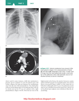 Basic radiology, 2nd ed.