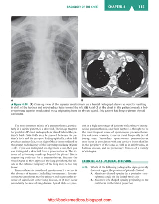 Basic radiology, 2nd ed.