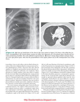 Basic radiology, 2nd ed.