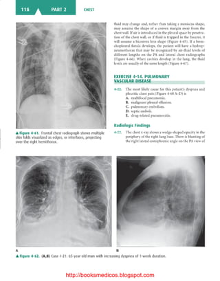 Basic radiology, 2nd ed.