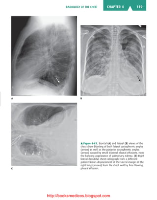 Basic radiology, 2nd ed.