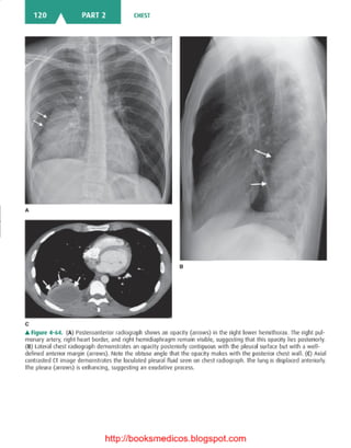 Basic radiology, 2nd ed.