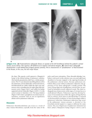 Basic radiology, 2nd ed.