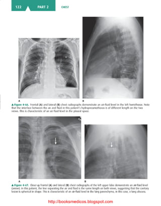 Basic radiology, 2nd ed.