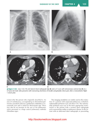 Basic radiology, 2nd ed.