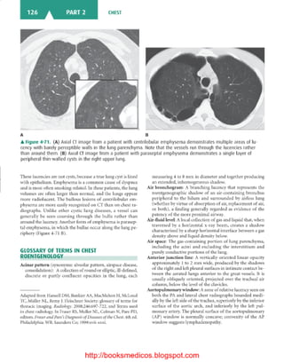 Basic radiology, 2nd ed.