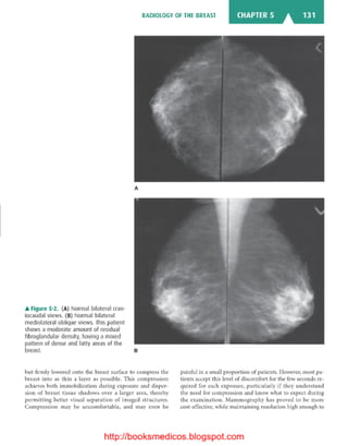 Basic radiology, 2nd ed.
