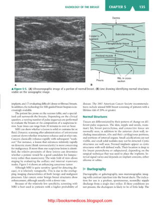 Basic radiology, 2nd ed.