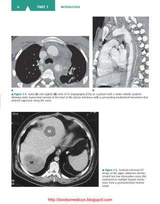 Basic radiology, 2nd ed.