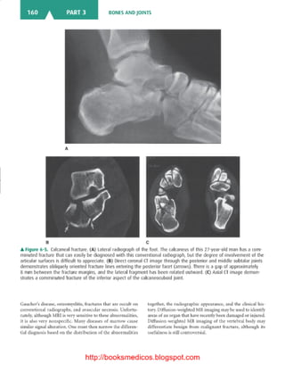 Basic radiology, 2nd ed.