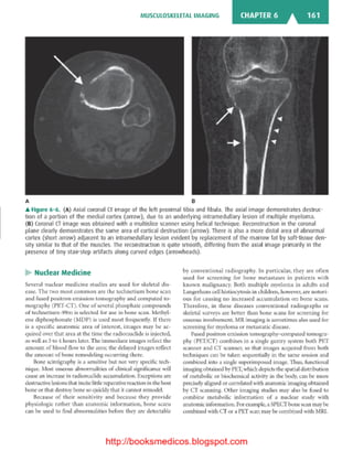 Basic radiology, 2nd ed.