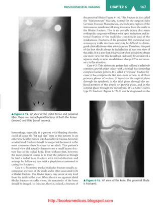 Basic radiology, 2nd ed.