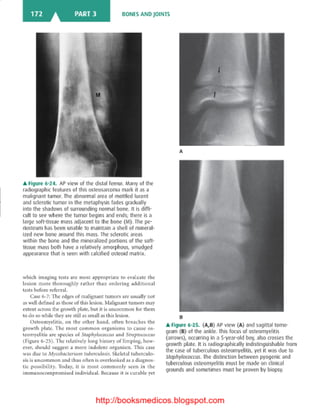 Basic radiology, 2nd ed.