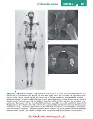 Basic radiology, 2nd ed.