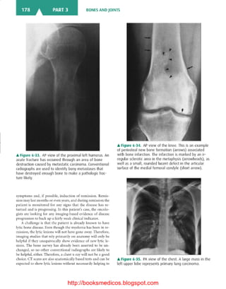 Basic radiology, 2nd ed.