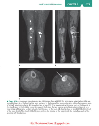 Basic radiology, 2nd ed.