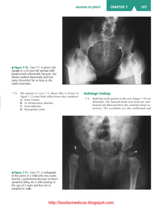 Basic radiology, 2nd ed.