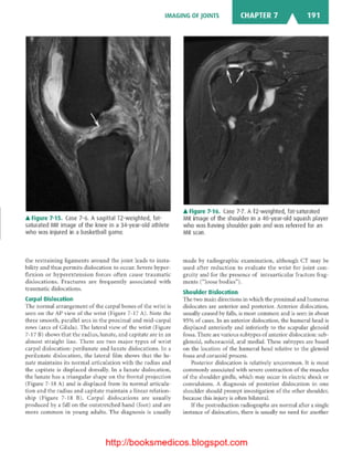 Basic radiology, 2nd ed.