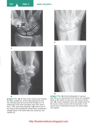 Basic radiology, 2nd ed.