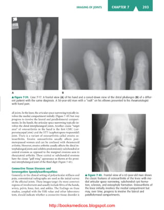 Basic radiology, 2nd ed.