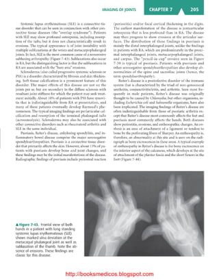 Basic radiology, 2nd ed.