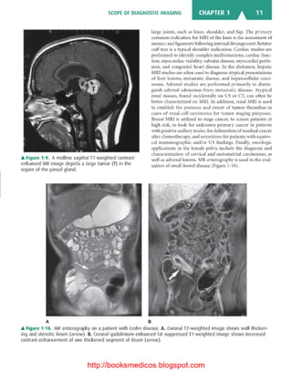 Basic radiology, 2nd ed.