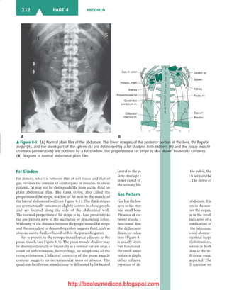 Basic radiology, 2nd ed.