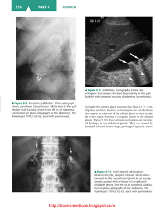 Basic radiology, 2nd ed.