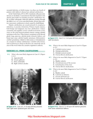 Basic radiology, 2nd ed.