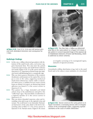 Basic radiology, 2nd ed.