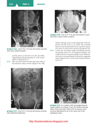 Basic radiology, 2nd ed.