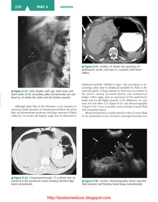 Basic radiology, 2nd ed.