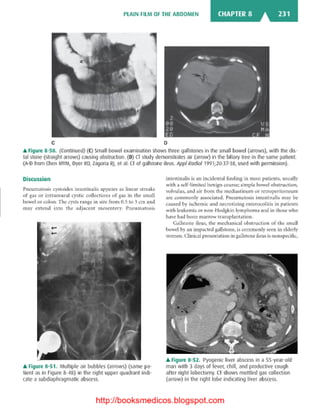 Basic radiology, 2nd ed.