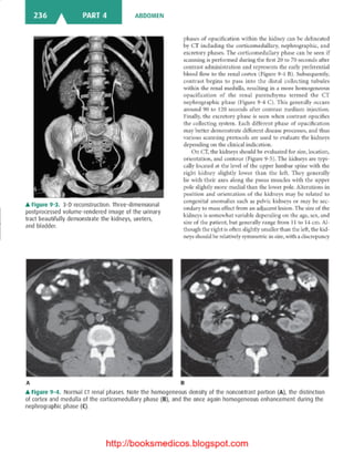 Basic radiology, 2nd ed.