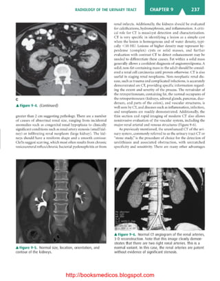 Basic radiology, 2nd ed.