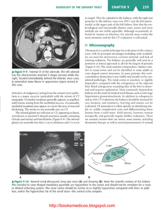 Basic radiology, 2nd ed.