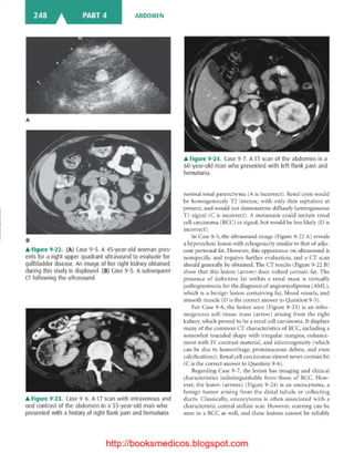 Basic radiology, 2nd ed.