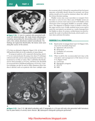 Basic radiology, 2nd ed.