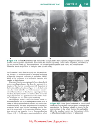 Basic radiology, 2nd ed.
