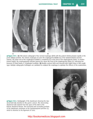 Basic radiology, 2nd ed.