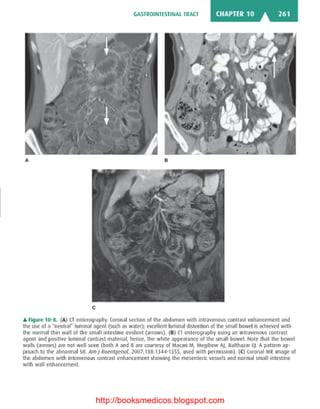 Basic radiology, 2nd ed.