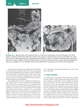 Basic radiology, 2nd ed.